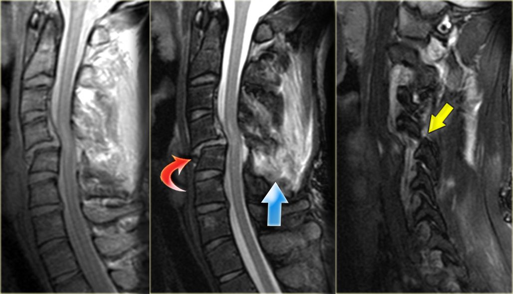 1920-20trauma20na20coluna20vertebral204-8466430